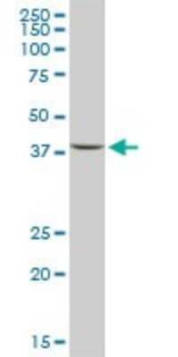 Western Blot: ACAA2 Antibody (2F7) [H00010449-M05]