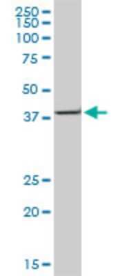 Western Blot: ACAA2 Antibody (2F7) [H00010449-M05]