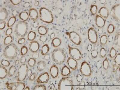 Immunohistochemistry-Paraffin: ACAA2 Antibody (5C4) [H00010449-M01]