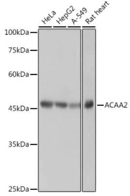 Western Blot: ACAA2 Antibody (8H6H5) [NBP3-15296]