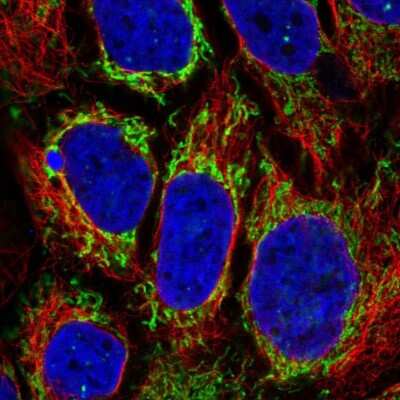 Immunocytochemistry/ Immunofluorescence: ACAA2 Antibody [NBP1-84974]