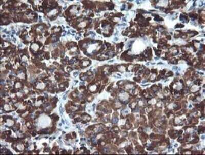 Immunohistochemistry: ACAA2 Antibody (OTI1C10) - Azide and BSA Free [NBP2-71602]