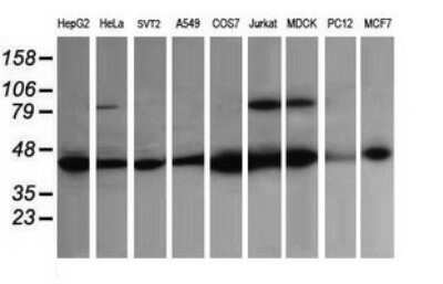 Western Blot: ACAA2 Antibody (OTI1C10)Azide and BSA Free [NBP2-71602]
