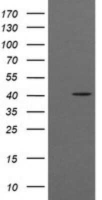 Western Blot: ACAA2 Antibody (OTI1C10)Azide and BSA Free [NBP2-71602]