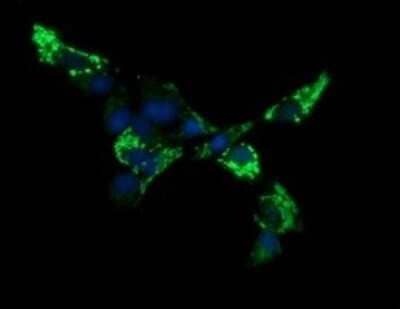 Immunofluorescence: ACAA2 Antibody (OTI1C10) [NBP2-46477]