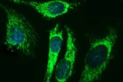 Immunofluorescence: ACAA2 Antibody (OTI1C10) [NBP2-46477]