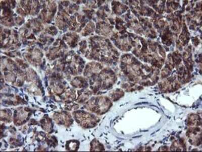 Immunohistochemistry: ACAA2 Antibody (OTI1C10) [NBP2-46477]