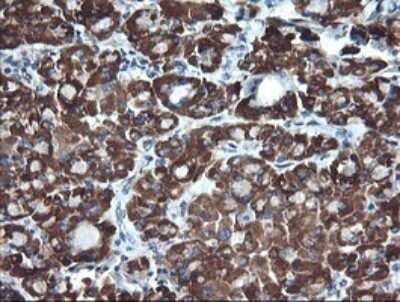 Immunohistochemistry: ACAA2 Antibody (OTI1C10) [NBP2-46477]