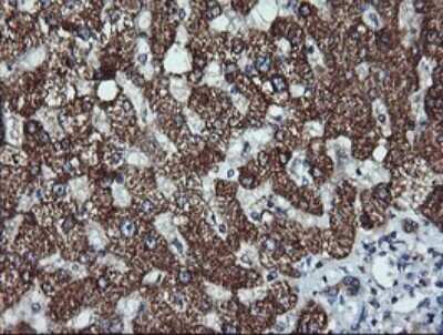 Immunohistochemistry: ACAA2 Antibody (OTI1C10) [NBP2-46477]