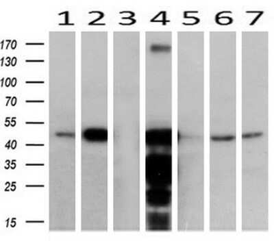 Western Blot: ACAA2 Antibody (OTI1C10) [NBP2-46477]