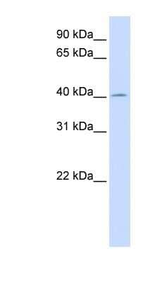 Western Blot: ACAA2 Antibody [NBP1-54746]