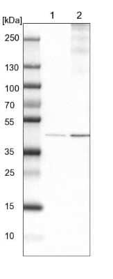 Western Blot: ACAA2 Antibody [NBP1-84974]