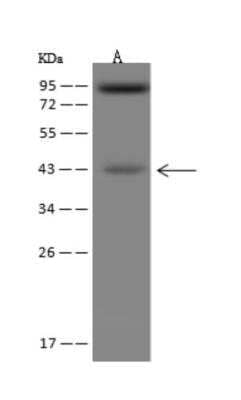 Western Blot: ACAA2 Antibody [NBP3-06401]