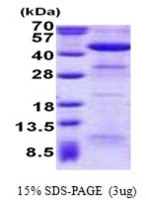 SDS-PAGE: Recombinant Human ACAA2 His Protein [NBP2-22665]