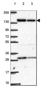 Western Blot: ACAD10 Antibody [NBP2-49511]