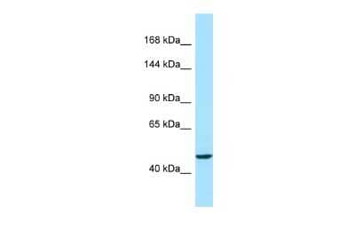 Western Blot: ACAD10 Antibody [NBP2-82565]