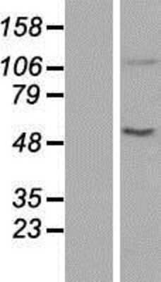 Western Blot: ACAD10 Overexpression Lysate [NBP2-06219]