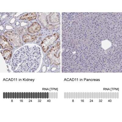 Immunohistochemistry-Paraffin: ACAD11 Antibody [NBP2-14255]