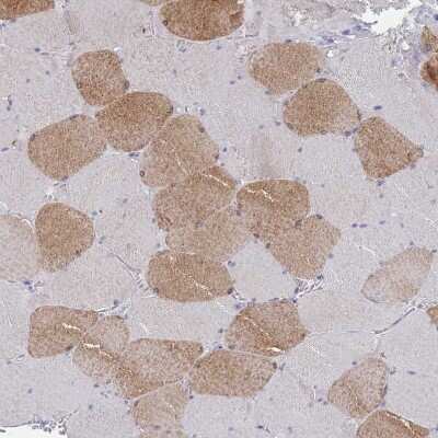 Immunohistochemistry-Paraffin: ACAD11 Antibody [NBP2-14255]