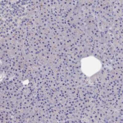 Immunohistochemistry-Paraffin: ACAD11 Antibody [NBP2-14255]
