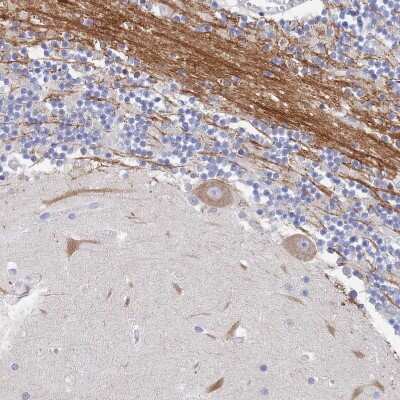 Immunohistochemistry-Paraffin: ACAD11 Antibody [NBP2-14255]