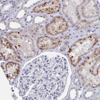 Immunohistochemistry-Paraffin: ACAD11 Antibody [NBP2-14255]