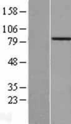 Western Blot: ACAD11 Overexpression Lysate [NBP2-06064]