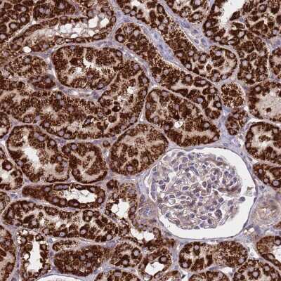 Immunohistochemistry-Paraffin: ACAD8 Antibody [NBP2-47559]