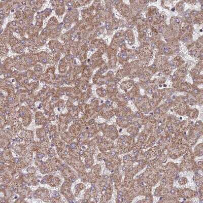 Immunohistochemistry-Paraffin: ACAD8 Antibody [NBP2-47559]