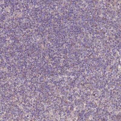 Immunohistochemistry-Paraffin: ACAD8 Antibody [NBP2-47559]