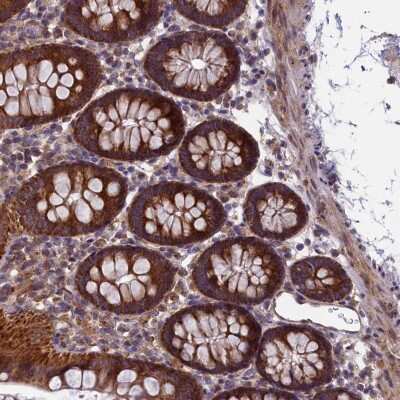 Immunohistochemistry-Paraffin: ACAD8 Antibody [NBP2-48529]