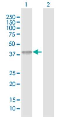 Western Blot: ACAD8 Antibody [H00027034-D01P]