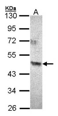 Western Blot: ACAD8 Antibody [NBP1-32224]