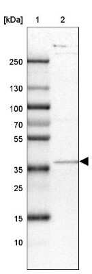 Western Blot: ACAD8 Antibody [NBP2-47559]