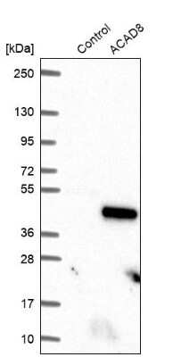 Western Blot: ACAD8 Antibody [NBP2-47559]