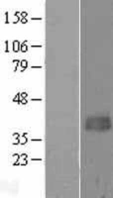 Western Blot: ACAD8 Overexpression Lysate [NBL1-07218]