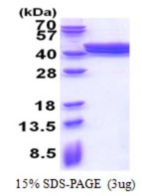 SDS-PAGE: Recombinant Human ACAD8 His Protein [NBP2-22674]