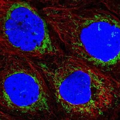 Immunocytochemistry/ Immunofluorescence: ACAD9 Antibody [NBP1-82749]