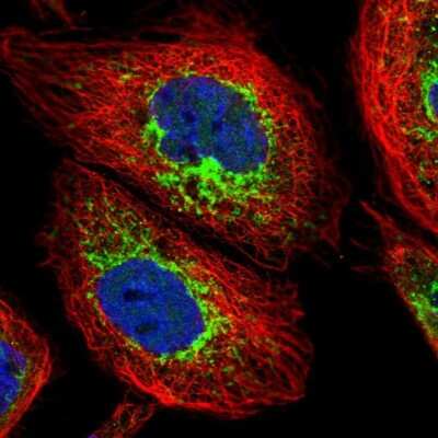Immunocytochemistry/ Immunofluorescence: ACAD9 Antibody [NBP2-56718]