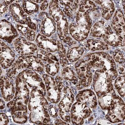 Immunohistochemistry-Paraffin: ACAD9 Antibody [NBP1-82749]