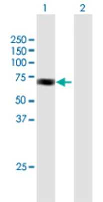Western Blot: ACAD9 Antibody [H00028976-B01P]