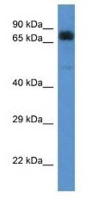 Western Blot: ACAD9 Antibody [NBP1-74272]