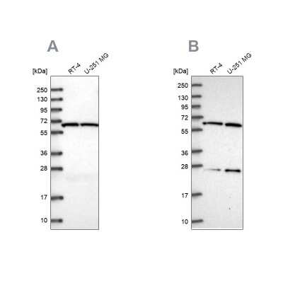 Western Blot: ACAD9 Antibody [NBP1-82749]