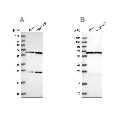 Western Blot: ACAD9 Antibody [NBP2-56718]