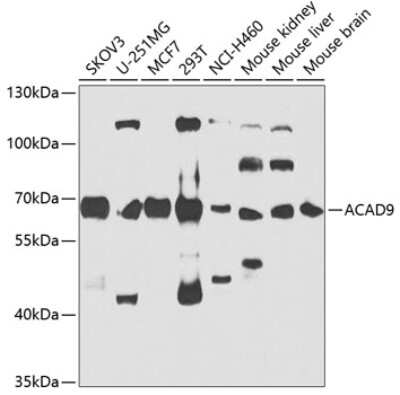 Western Blot: ACAD9 AntibodyBSA Free [NBP2-92680]