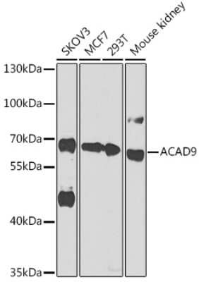 Western Blot: ACAD9 AntibodyBSA Free [NBP2-92735]