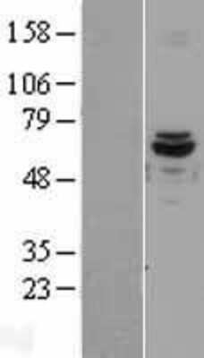 Western Blot: ACAD9 Overexpression Lysate [NBL1-07219]