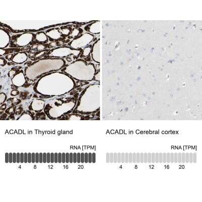 Immunohistochemistry-Paraffin: ACADL Antibody [NBP1-89289]