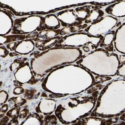 Immunohistochemistry-Paraffin: ACADL Antibody [NBP1-89289]