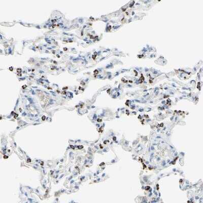 Immunohistochemistry-Paraffin: ACADL Antibody [NBP1-89289]
